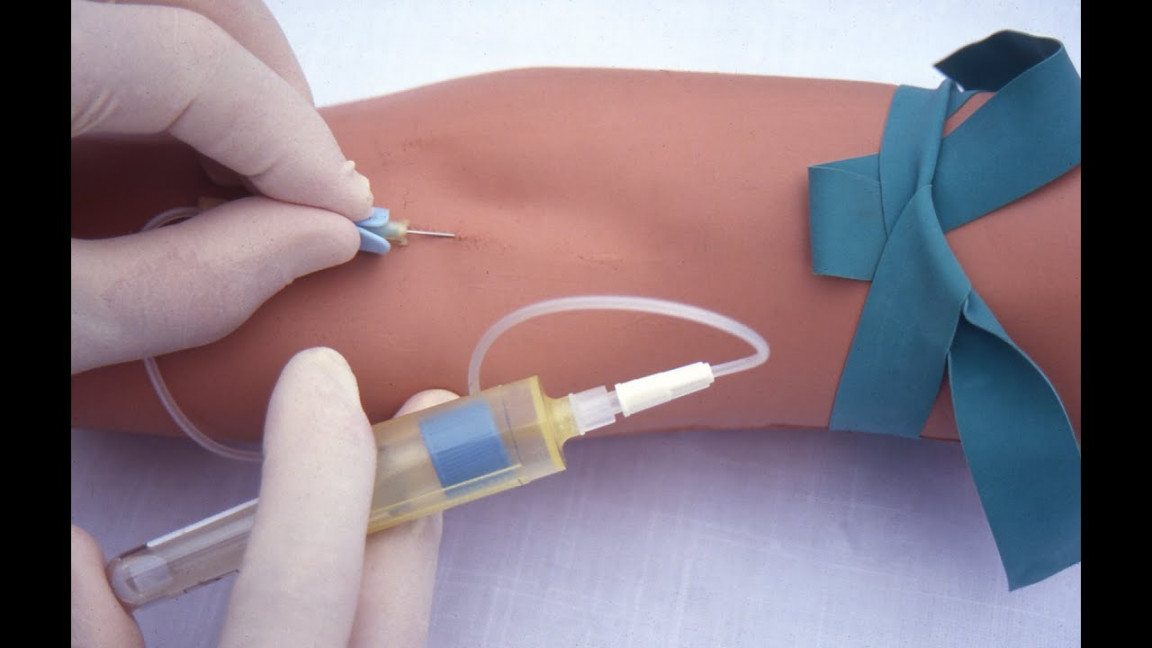 Performing a venipuncture using a butterfly needle